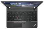 Lenovo Thinkpad E565 (20EY000AUS) Laptop (AMD Dual Core A6/4 GB/500 GB/Windows 7)